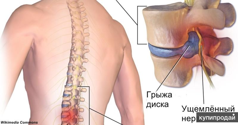 Дьюралан раствор в/суставной 60 мг/3 мл n1 шприц - купить в Болит низ живота и поясница: что это может быть, причины