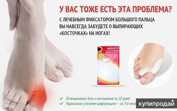 Фиксатор Valgus Pro (фиксатор против выпирающих косточек на ногах)
