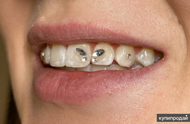 Скайсы на зубы Томск Карьерный стоматология наб ушайки томск