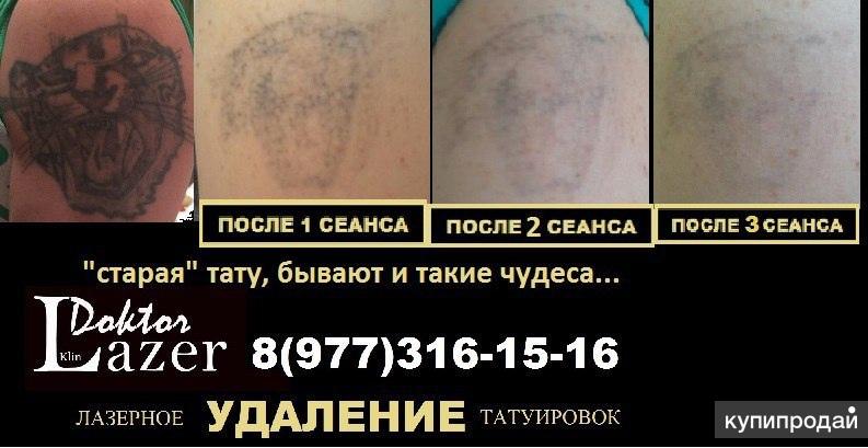 Татуировка сколько нельзя в баню. Сведение старых татуировок. Татуировки после сведения.