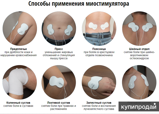 Миостимулятор схема наложения электродов