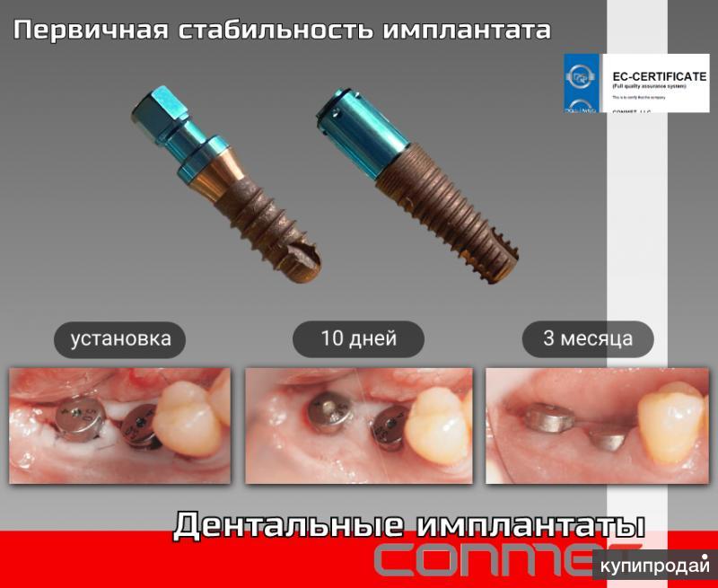 мини импланты конмет. система имплантов конмет. конмет имплантаты винт. ключ для мини имплантат конмет. конические и цилиндрические имплантаты.