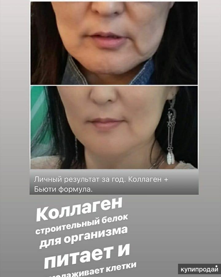 Коллаген нл отзывы фото до и после