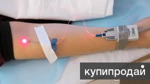 Лазерное и ультрафиолетовое облучение крови