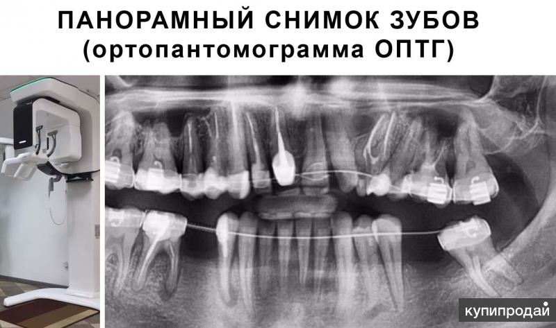 Панорамный Снимок Зубов Спб Цена