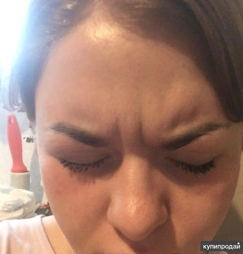 Косметология. Косметология инъекции для лица. Диспорт релатокс ксеомин. Ботулотерапия. Ботокс в межбровку до и после.